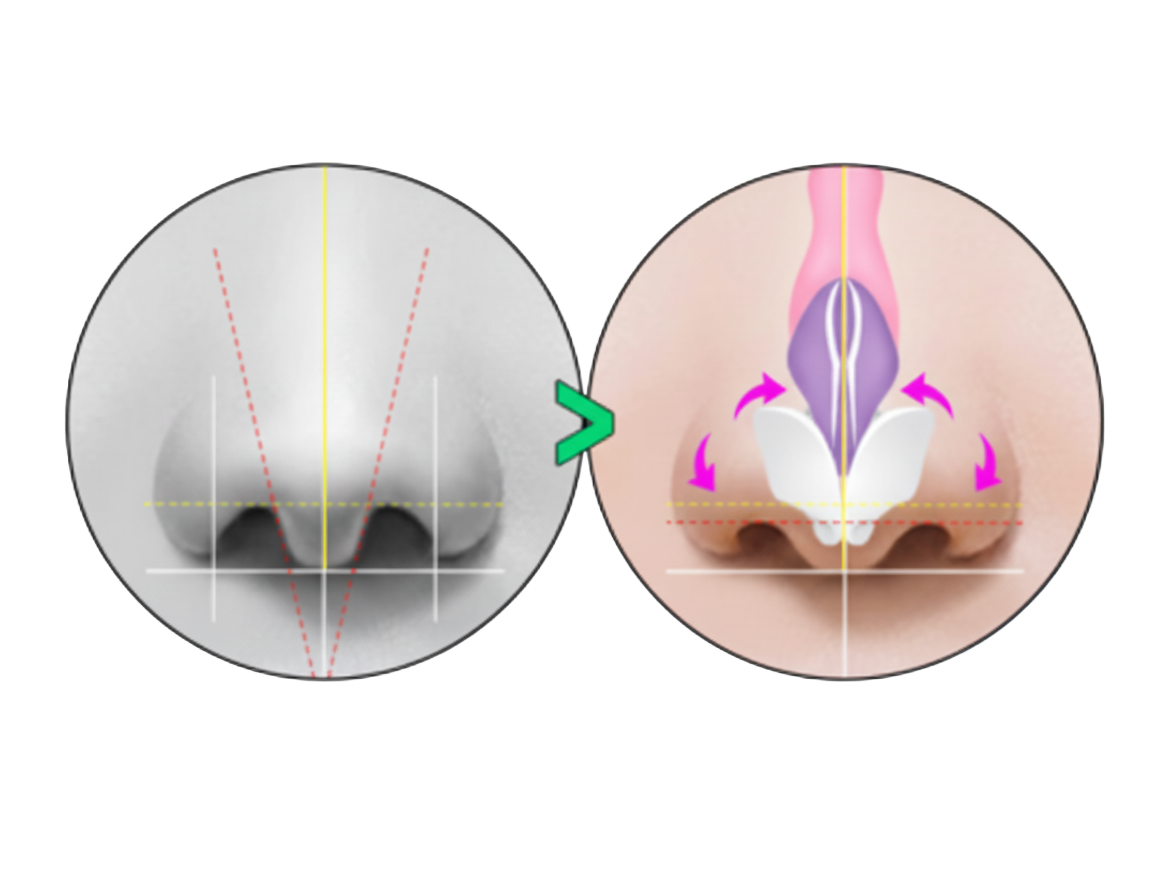 자연스러운 콧대라인