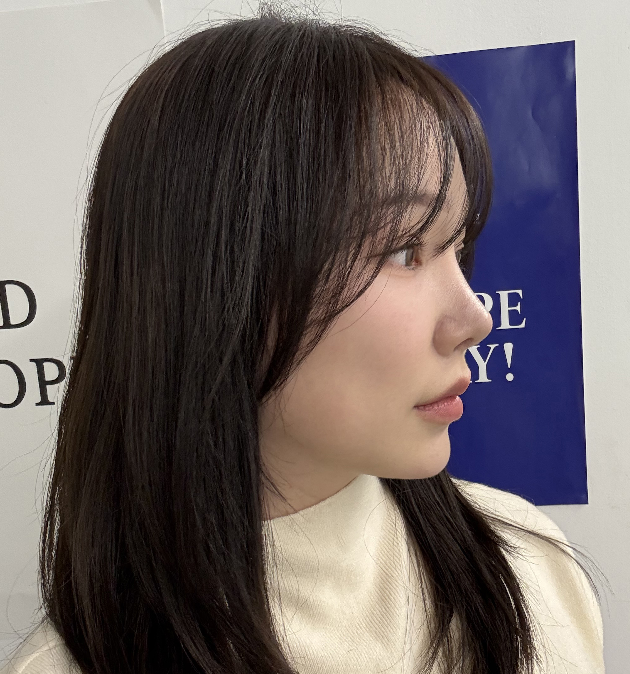 내시경이마거상과 코재수술 대만족! 후회없어용