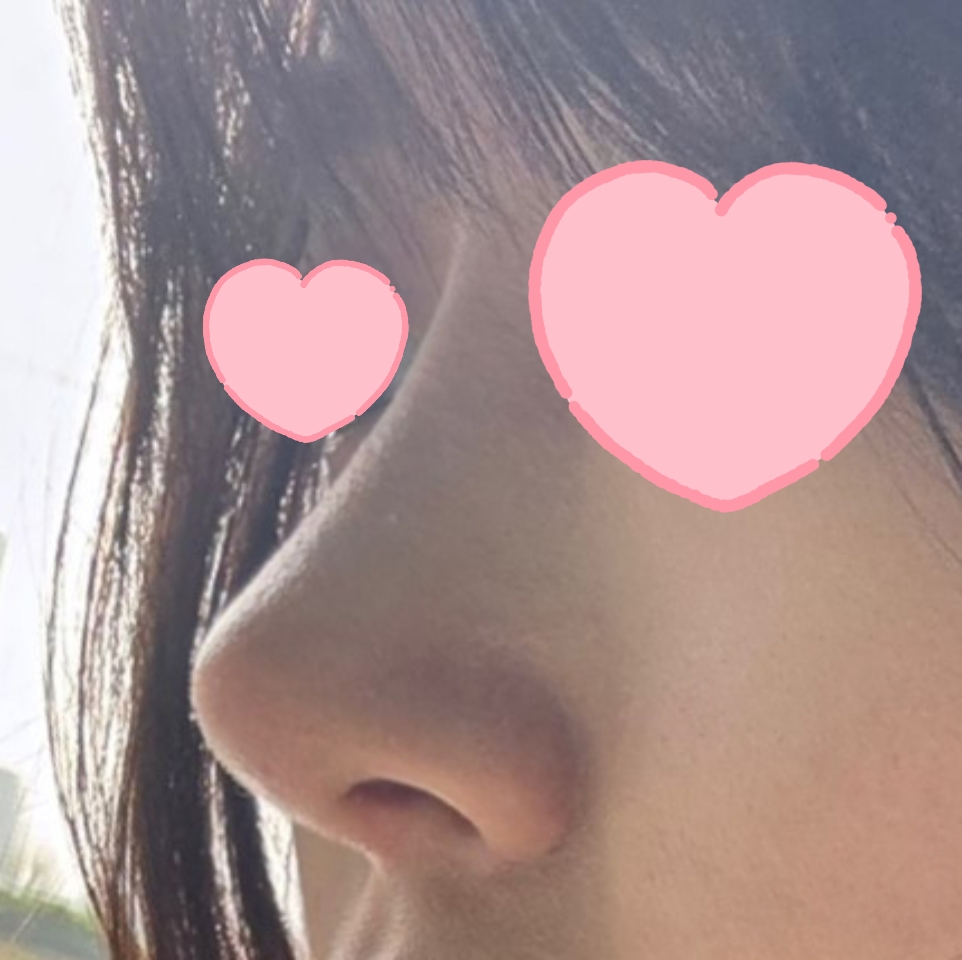 원장님 덕분에 예뻐졌어요 ~!