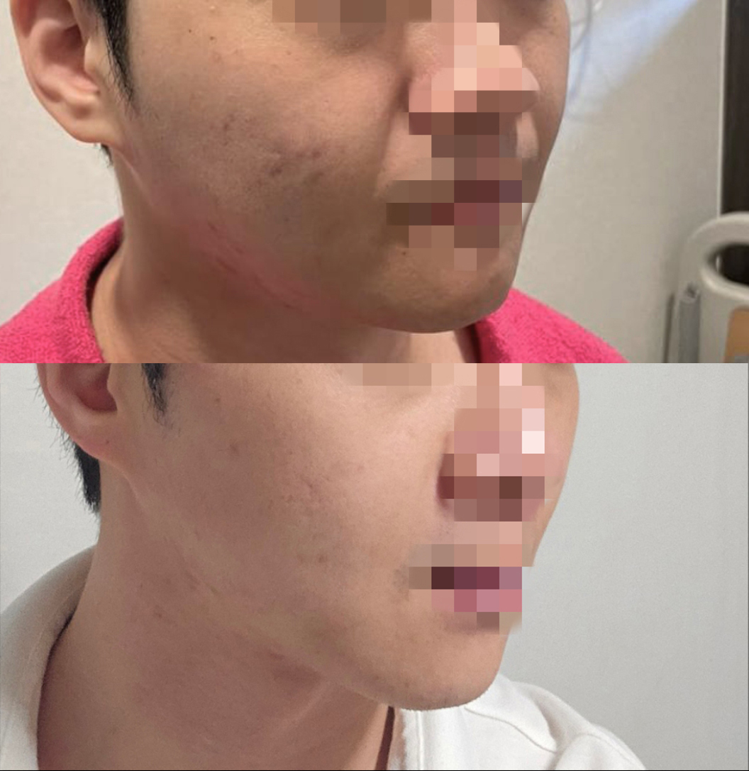 부담없이 얼지흡 받을만 합니다