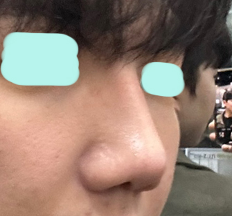 컴플렉스였던 코가 이젠 자랑스러워요