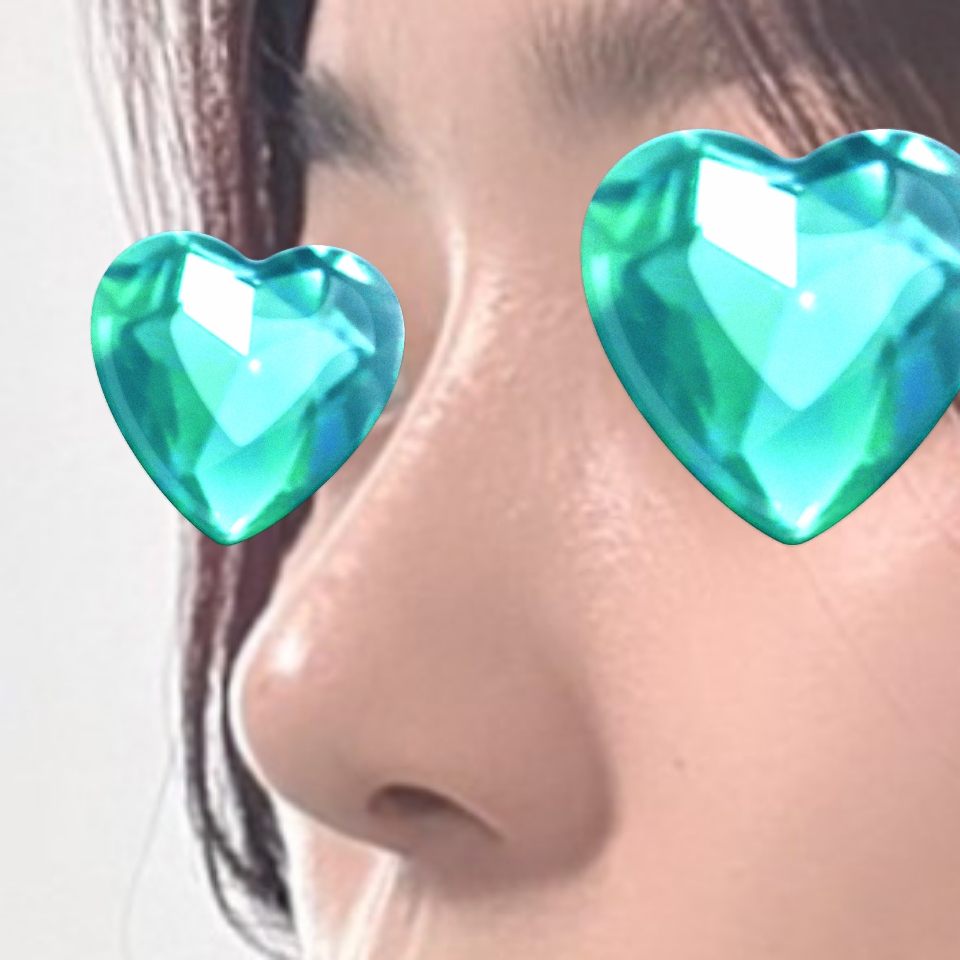 코수술 후 더 나은 삶을 살 수 있게 되었습니다 ㅎㅎ