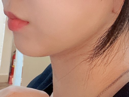 원장님 덕분에 브이라인 됐습니당