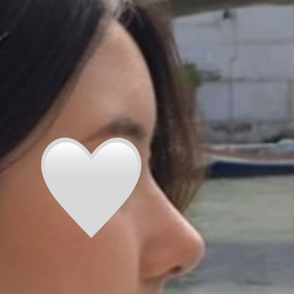 주변에서도 전부 수술 잘 됐다고 난리예요