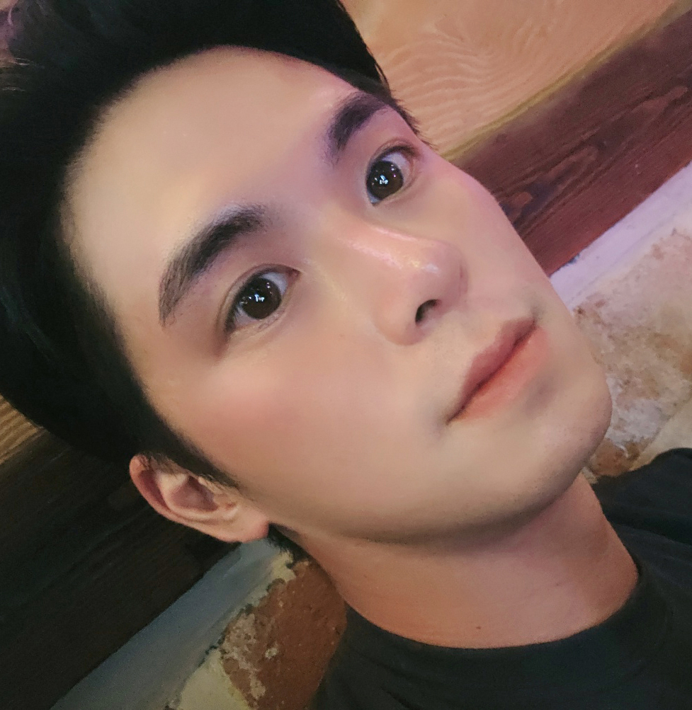 바이브에서 눈, 코수술 받았습니다.