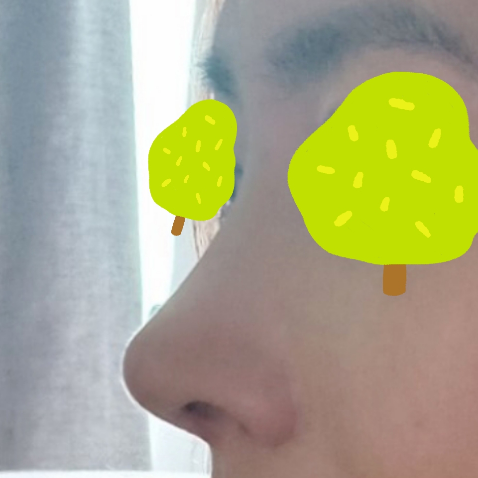 수술 대만족입니다 감사합니다