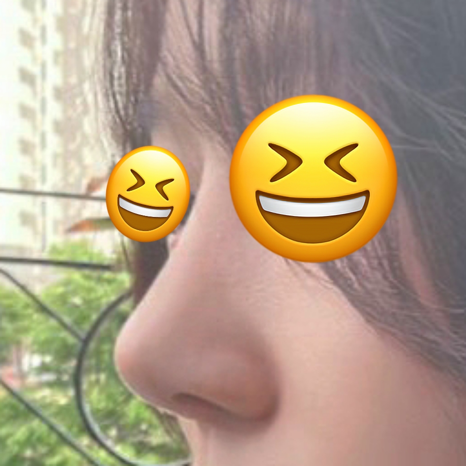 제가 원하는 모양대로 코수술 해주셨어용