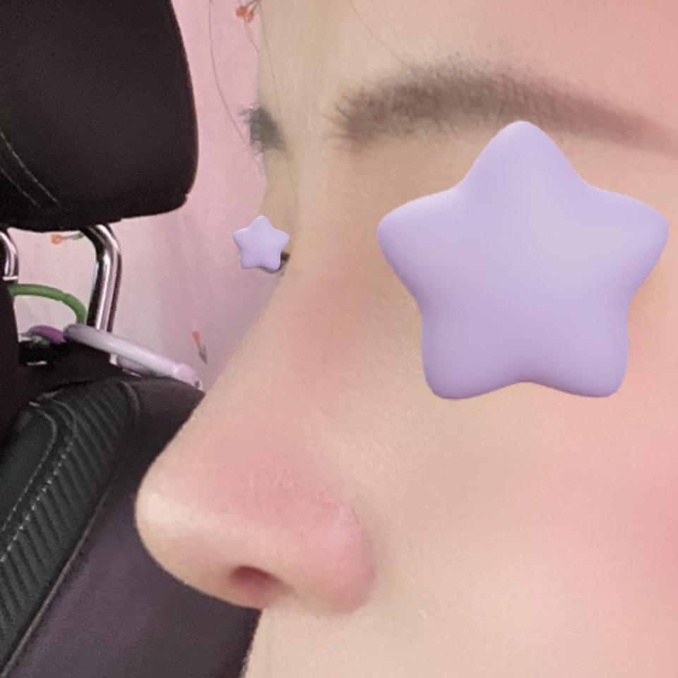 수술 후회 없습니다 !