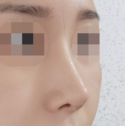 코3번째수술병원 바이브로 정했어요