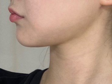 유원장님 덕분에 이중턱이 사라졌어요 ! 감사합니다 ㅎㅎ