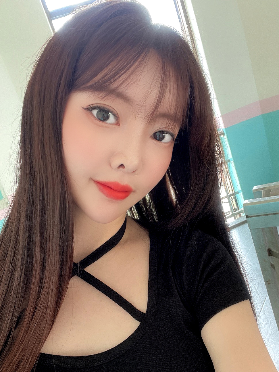 눈매교정재수술, 이중턱지흡!