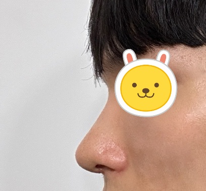 결과도 좋고 사후관리도 좋아요