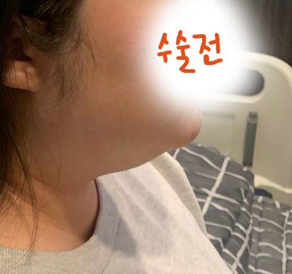 수술전_1_.jpg