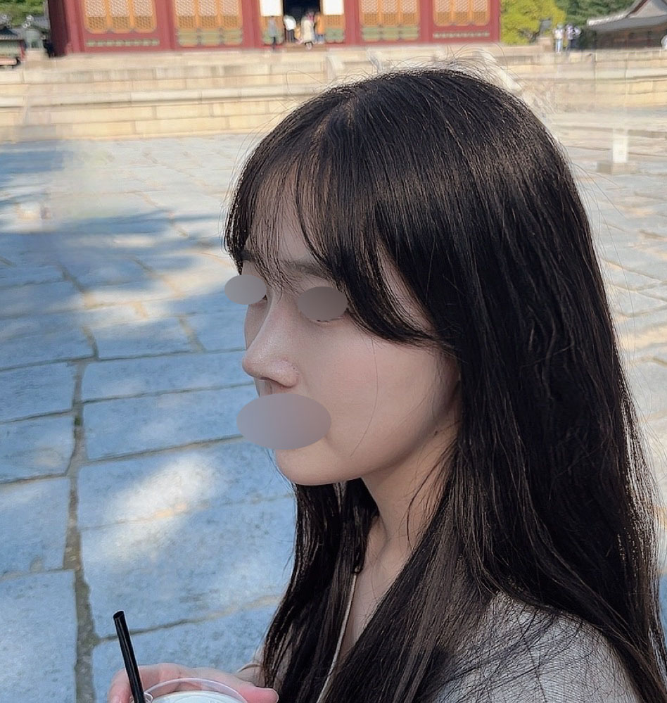 눈, 코 바이브에서 하길 잘했어요!