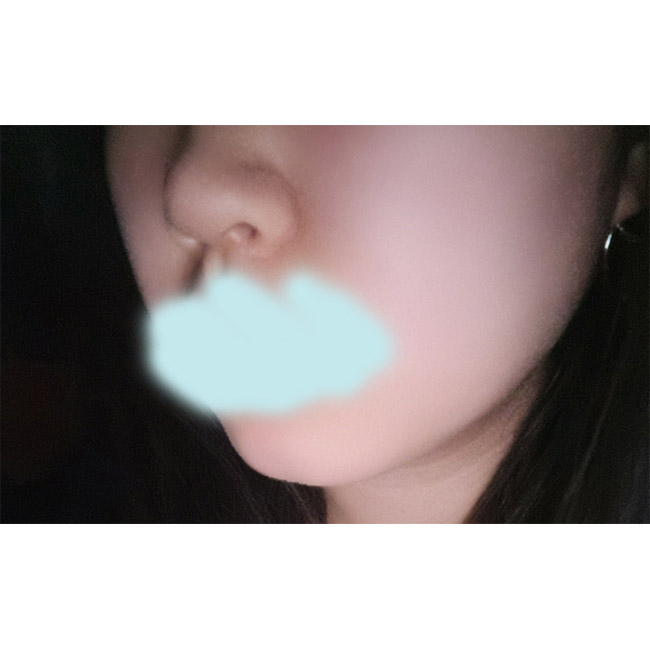 얼지흡3갤차 전후비교!