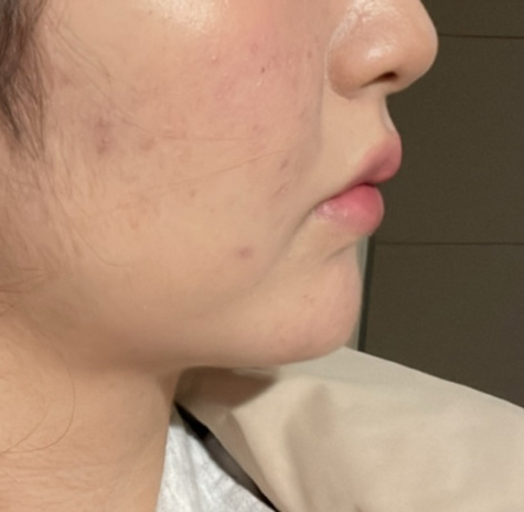 얼지흡 너무너무너무 만족합니다!!