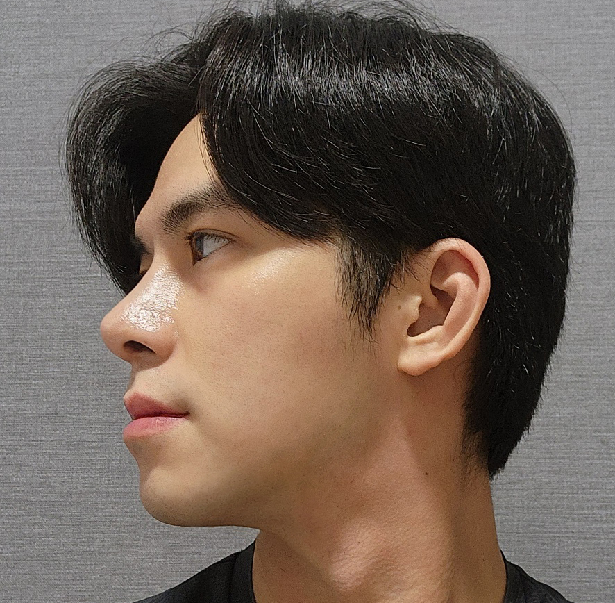 유원장님께 눈, 코성형받고 새삶 살고있습니다.