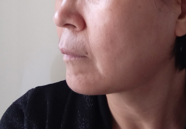 엄마 턱라인이 갸름해지셨어요^^