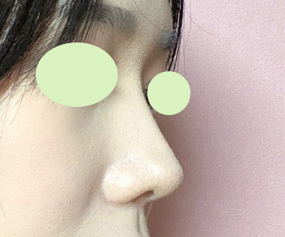 이번엔 코 정말 잘된거같습니닷><