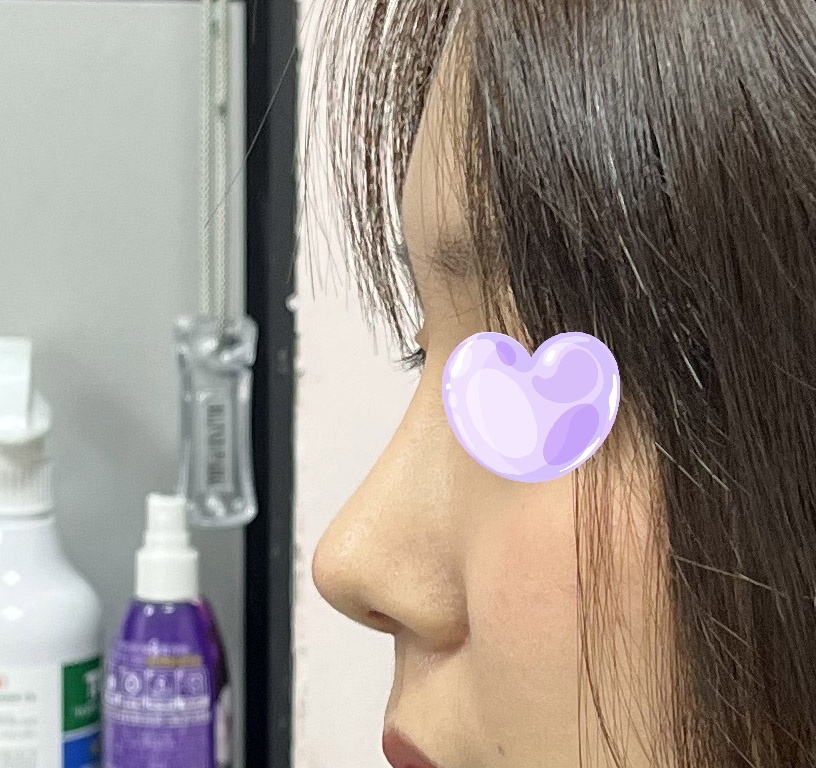 코 자연스럽구 예뻐용ㅠㅠ!