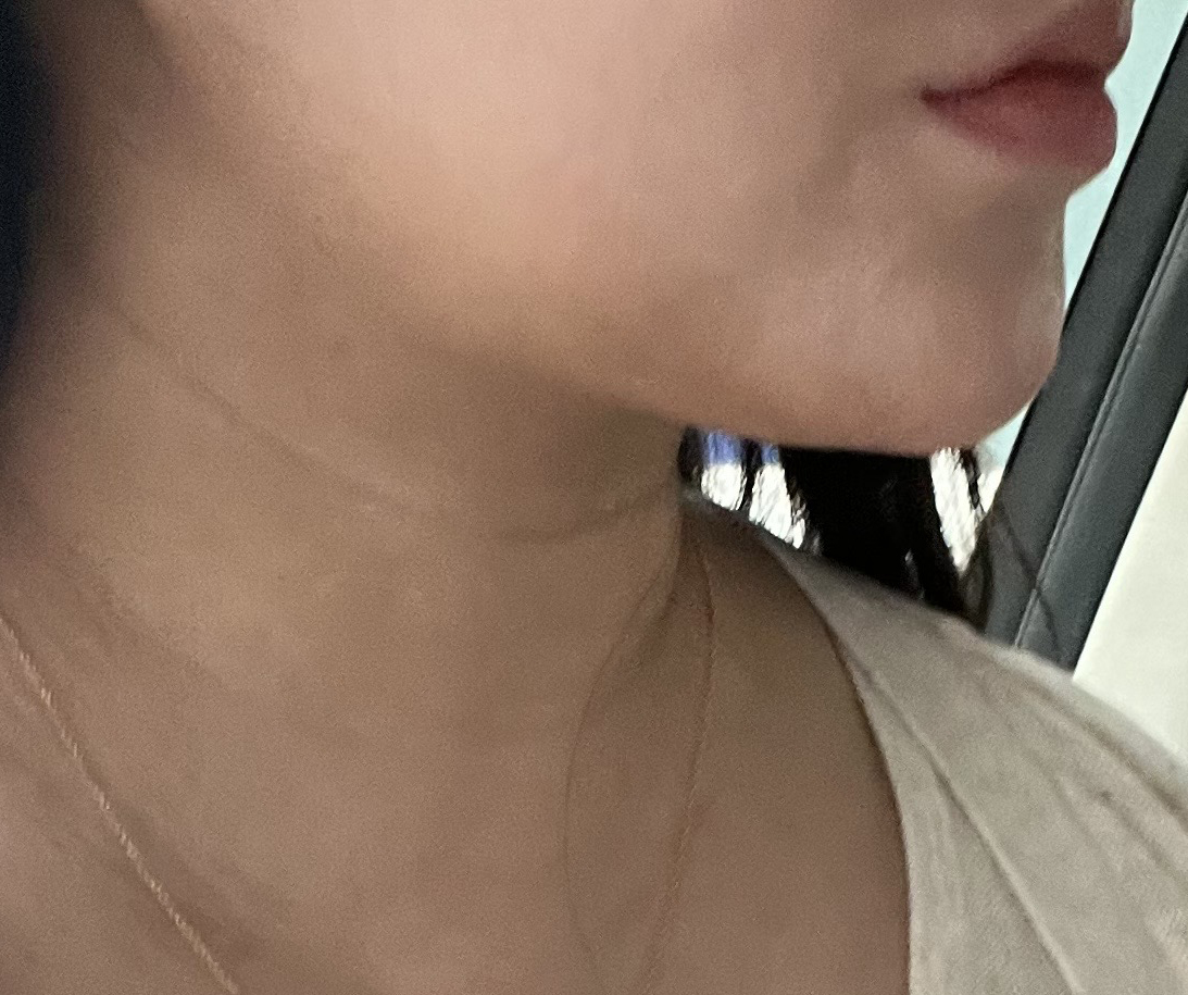 얼지흡하구 턱라인이 살아났습니다 ㅎㅎ