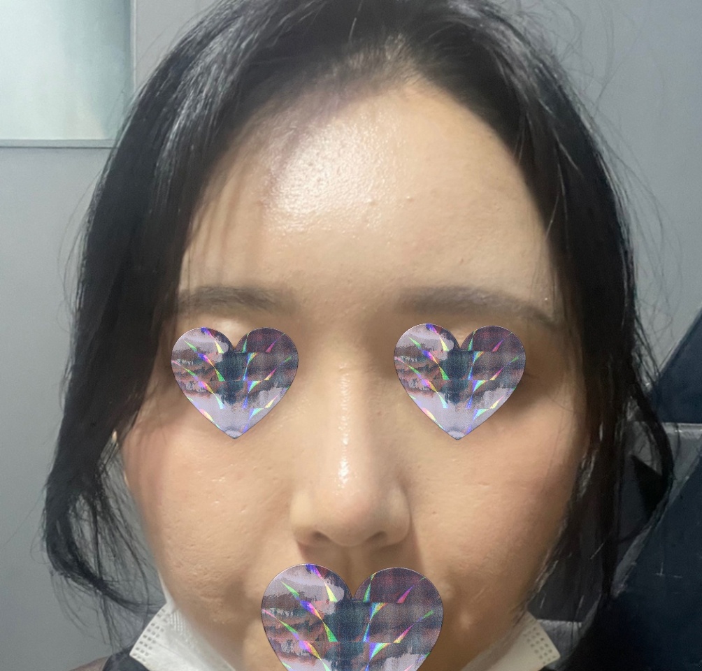 수술후_3_.jpg
