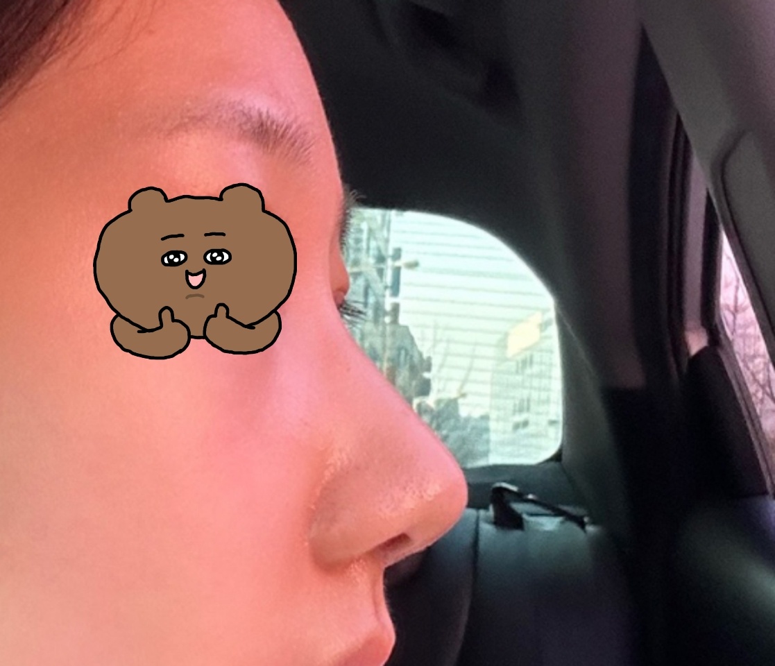 첫눈, 첫코 만족후깅