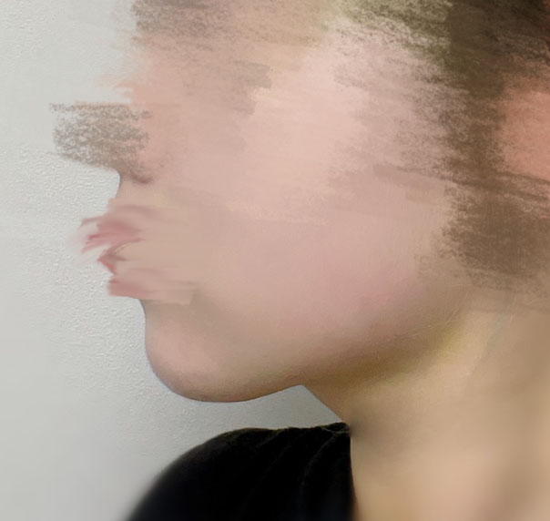 얼지흡으로 턱살뿌신지 1달차입니닷