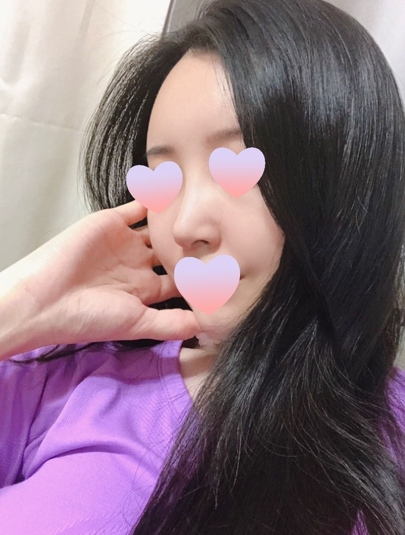 수술후__1_.jpg