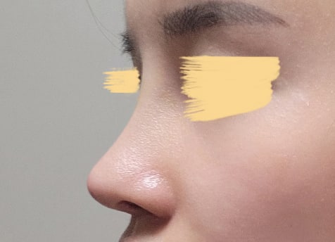 유영문 원장님 정말 감사합니다!