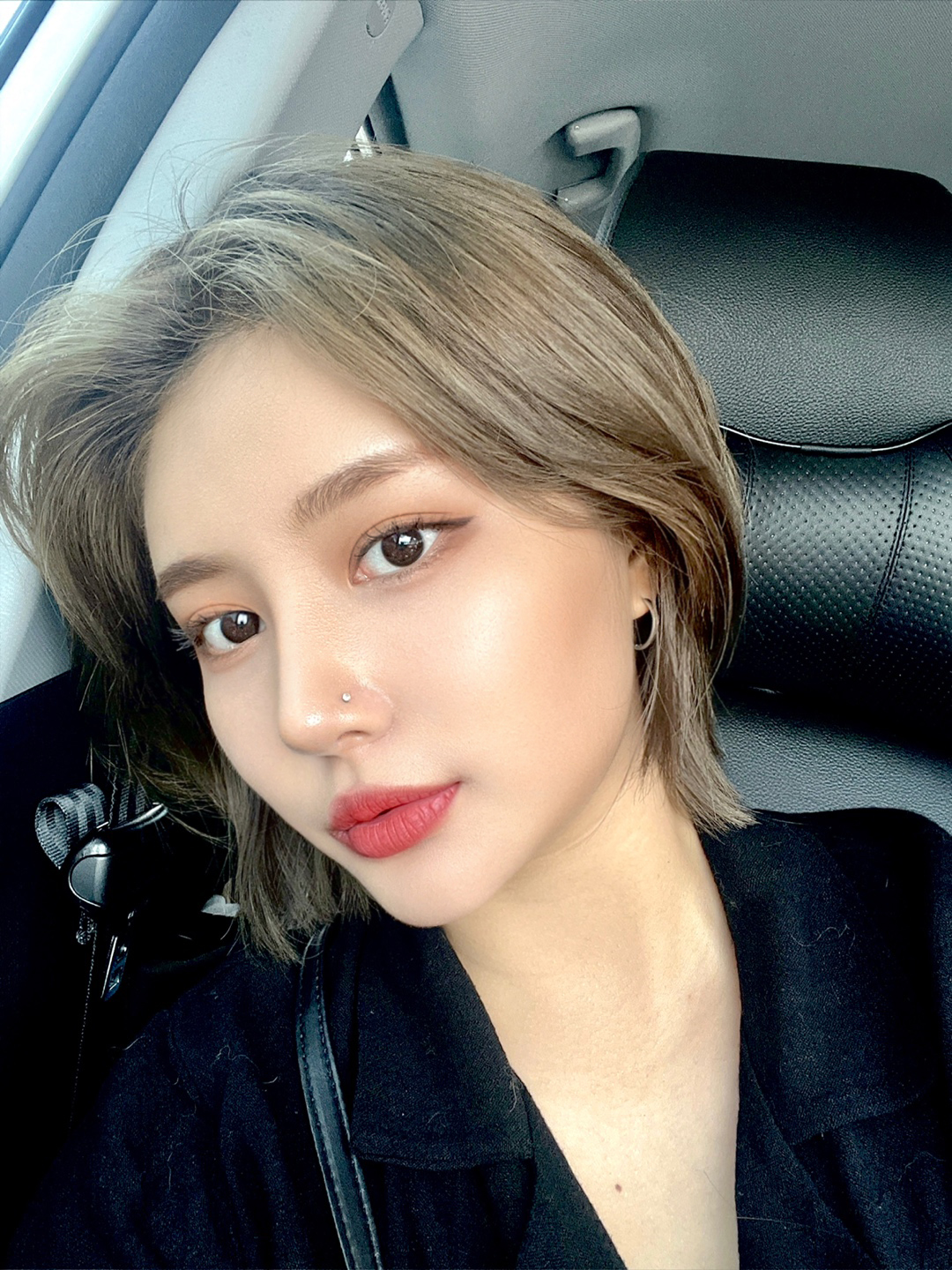 바이브에서 수술 받은지 벌써 1년차!