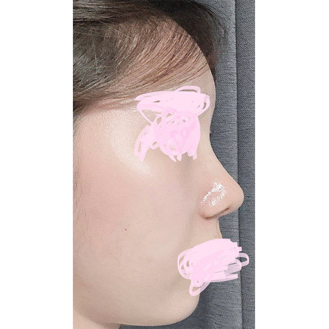 라인이 너무 마음에 들어요 ㅎㅎ