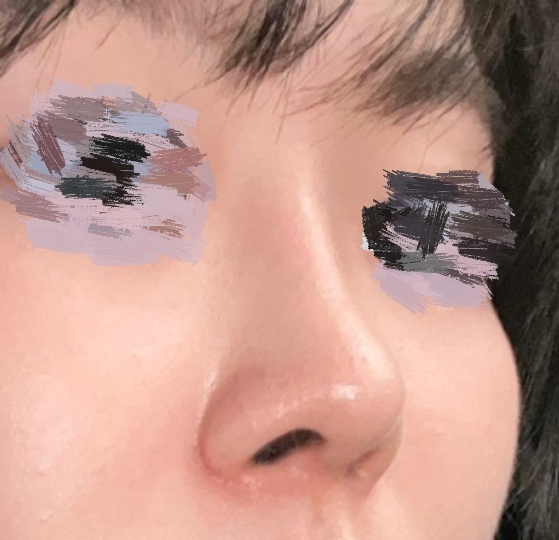 바이브덕분에 예쁜코로 지내는중!