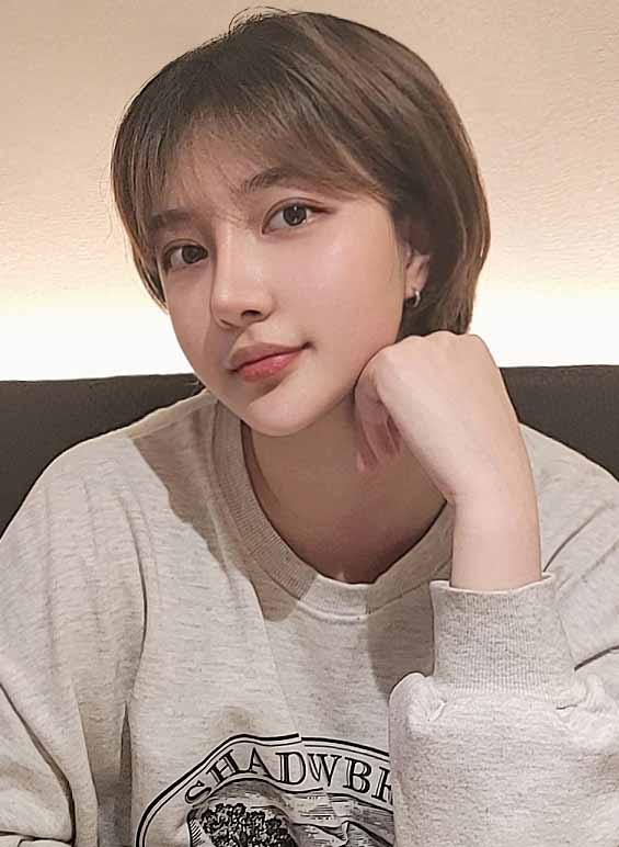 바이브에서 수술하길 정말 잘한듯!