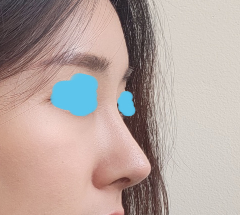 어느각도에서 봐도 이쁜 코ㅎㅎㅎ