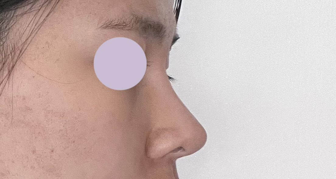 벌써 눈이랑코한지 6개월이 넘었네요!