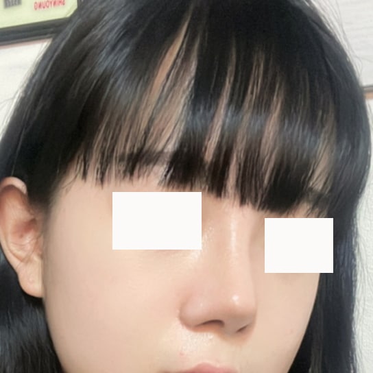 코 할꺼면 여기 강력추천ㅎㅎ