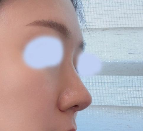 주변에서 예뻐졌다구해요ㅎㅎ-코,얼지흡4갤차!