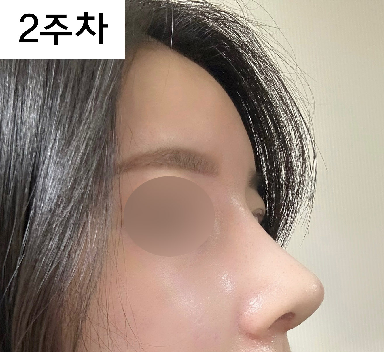 수술후_1_-1.jpg