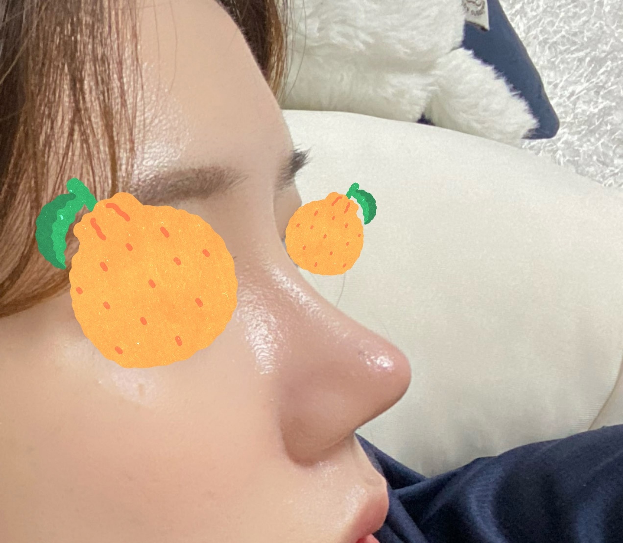 이번 코성형 너무 맘에 드네용