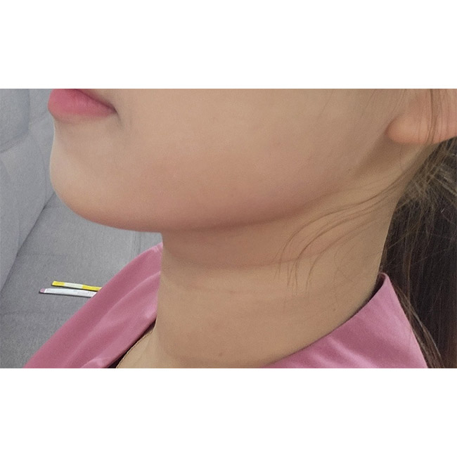 이중턱 사라져서 넘좋아용