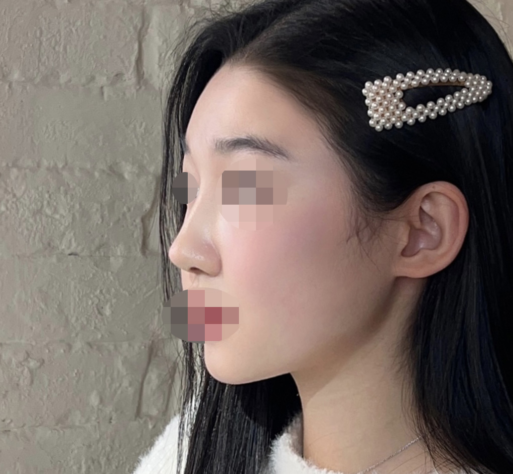 자연스럽게 이쁜코 만들어주셨오요~!