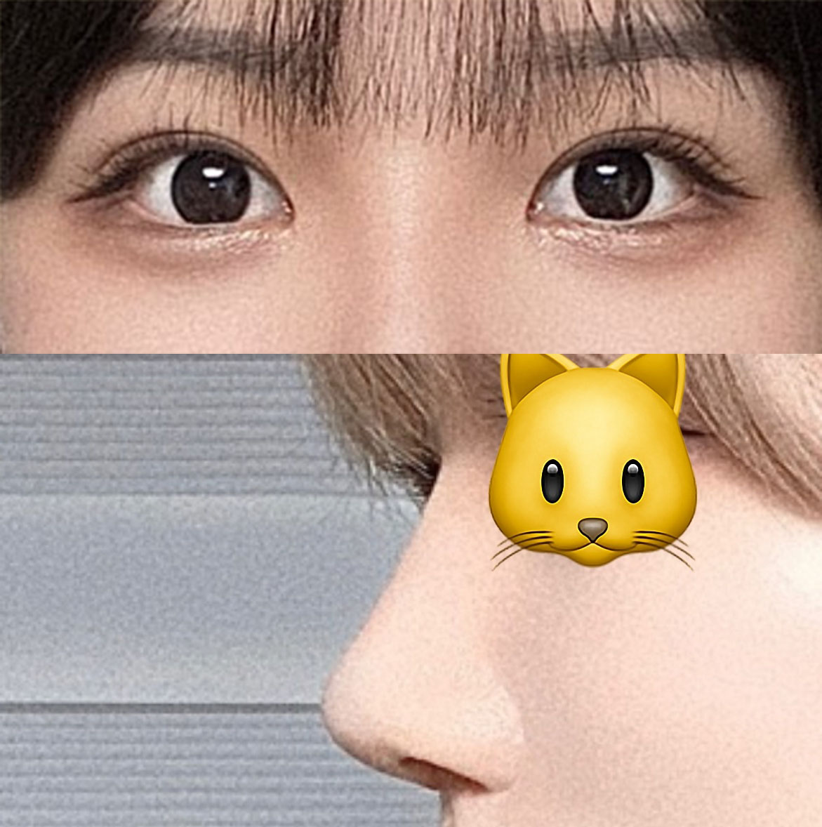 눈재수술, 첫코 모두 만족!