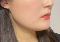 효과 너무 좋아요ㅠㅠ!