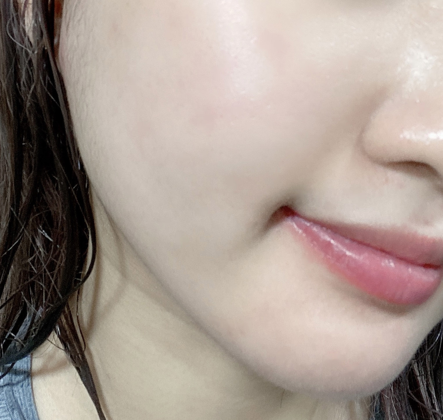 얼굴지방흡입 추천추천bb