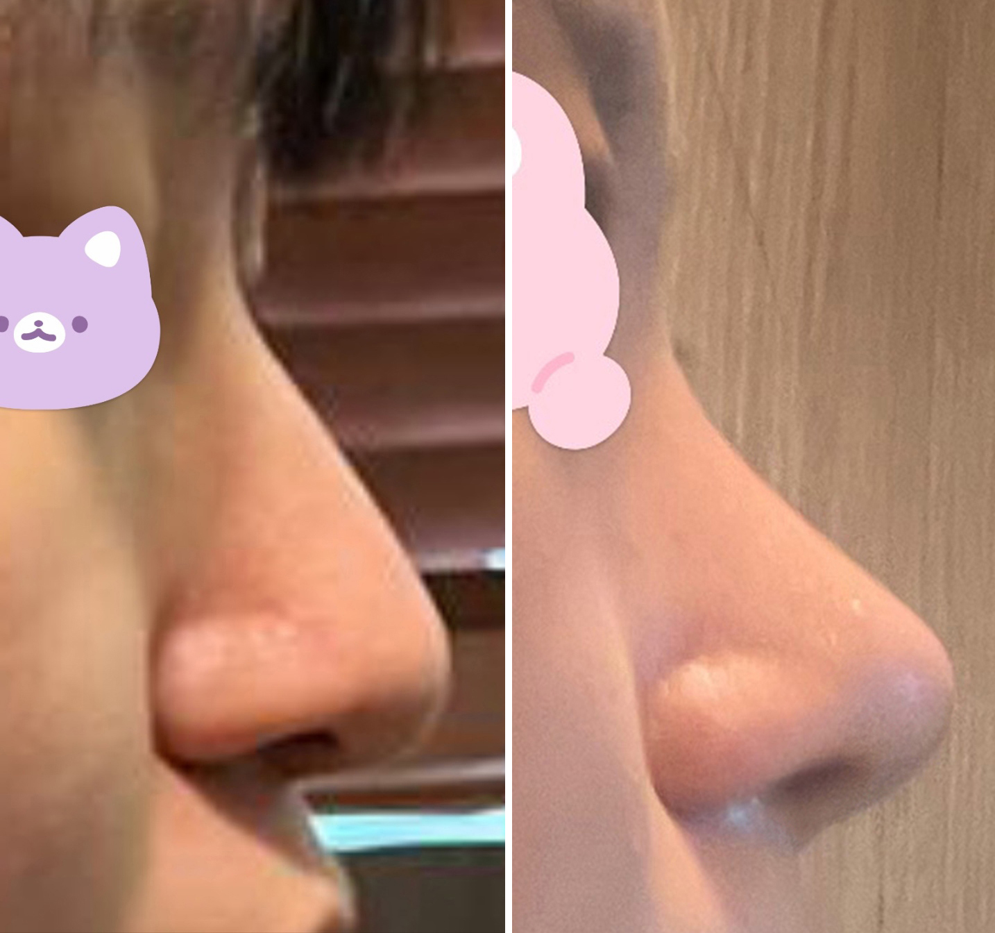 자연스럽게 오똑해져서 좋아요