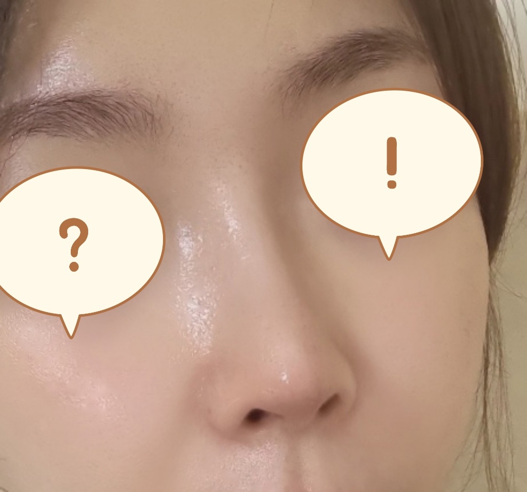 예쁜 코, 눈만들어주셔서 감사합니다~원장님!