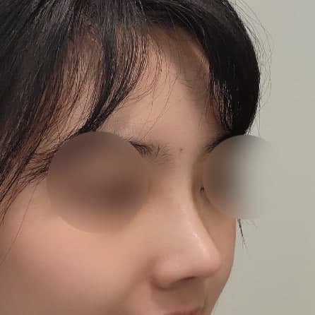 사진 찍을때 옆모습이 좀 더 라인이 살아나는 느낌이라 너무 만족스러워요ㅎㅎ