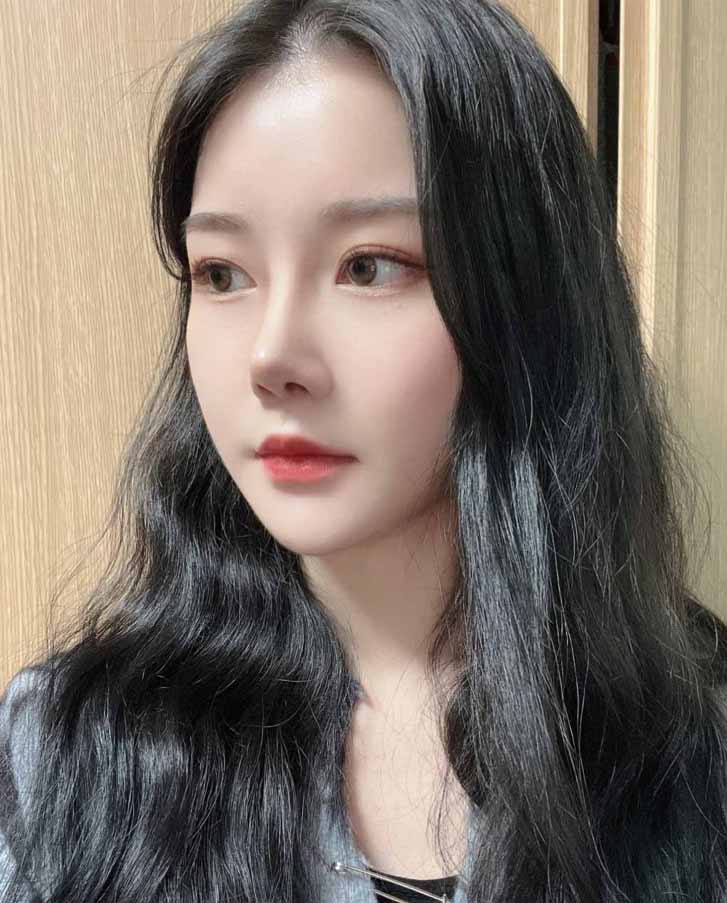 코성형하고 사진 찍을때 마다 자신감 뿜뿜~