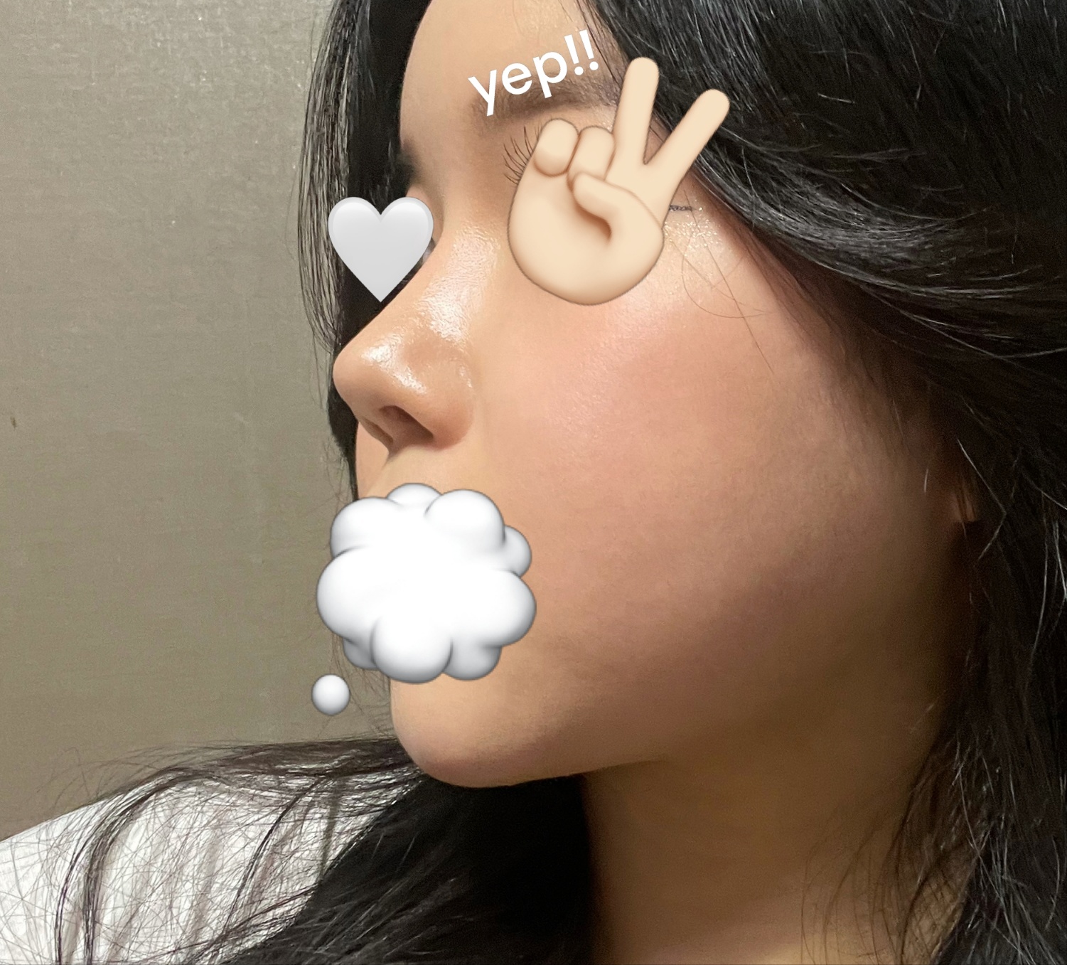 코재수술&얼지흡 8갤차><